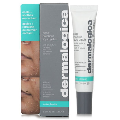 Dermalogica Deep Breakout Liquid Patch (Exp. Date 31 OCT 2026) 15ml/0.5oz
